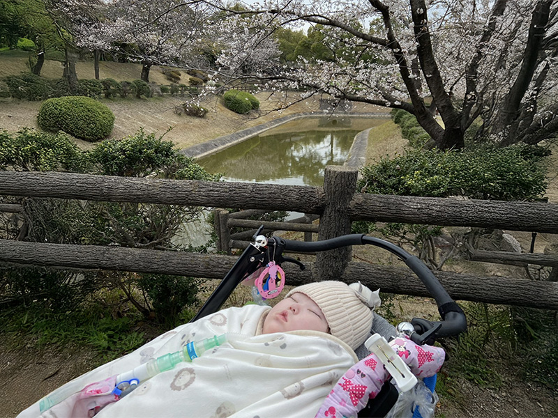 乳幼児期の重症児も対象に